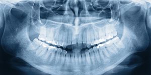 10 برند برتر رادیوگرافی دندانپزشکی